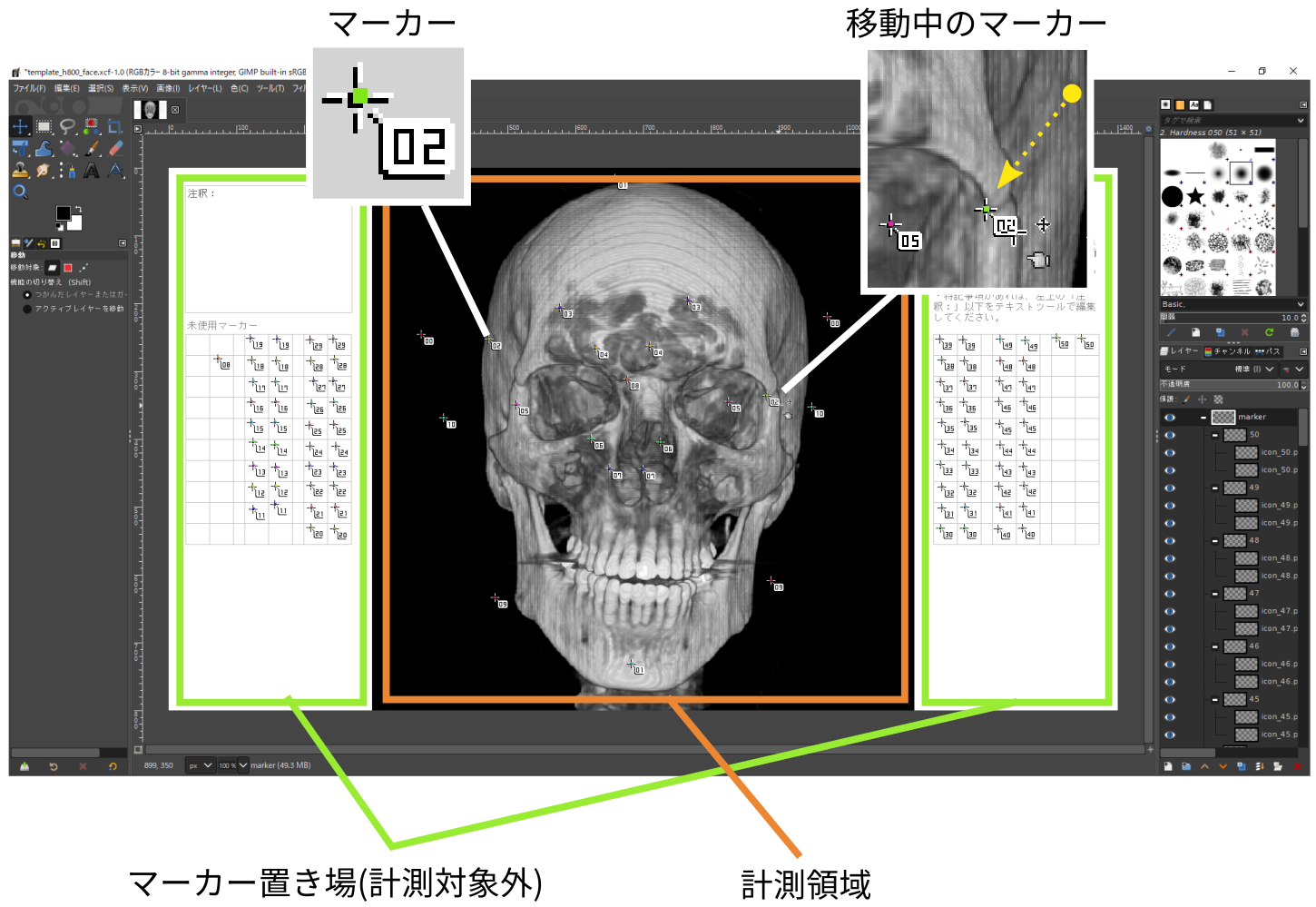 図2:計測テンプレートの例