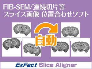 exfact-slice-aligner-2-0-01_w300.jpg
